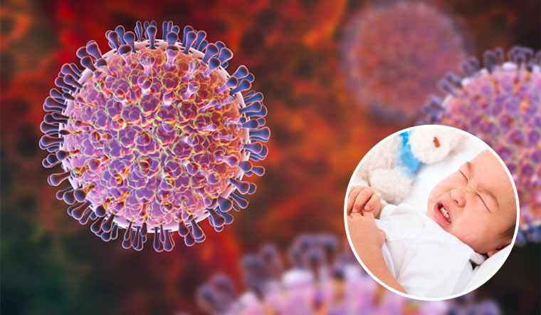 Rotavirus là gì - Nguyên nhân, triệu chứng và cách phòng ngừa hiệu quả